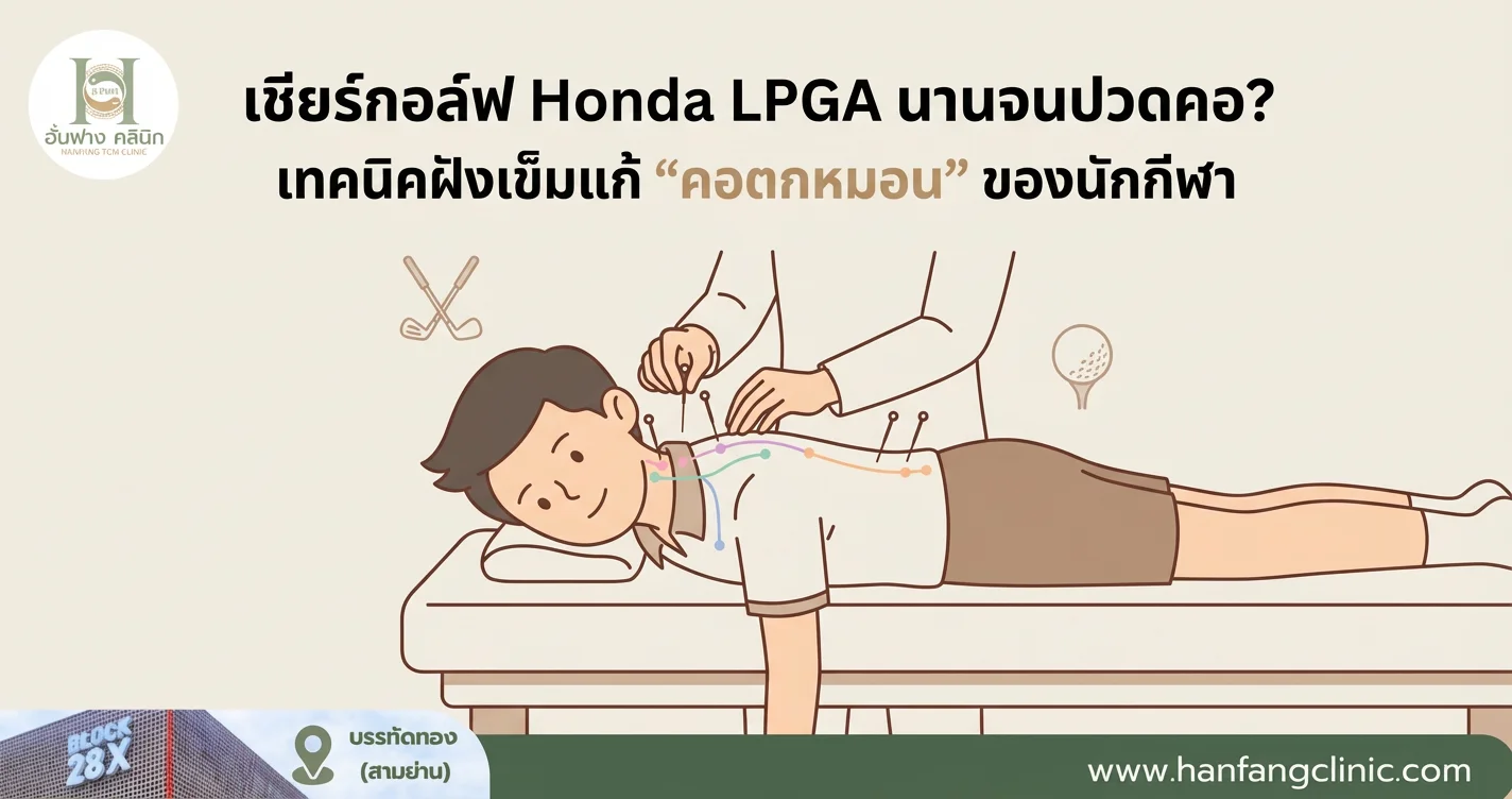 เชียร์กอล์ฟ Honda LPGA นานจนปวดคอ? เทคนิคฝังเข็มแก้ 'คอตกหมอน' ของนักกีฬา