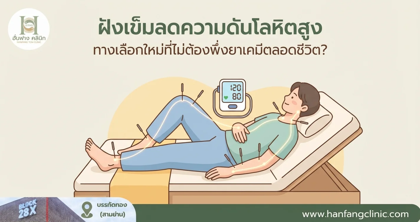 ฝังเข็มลดความดันโลหิตสูง ทางเลือกใหม่ที่ไม่ต้องพึ่งยาเคมีตลอดชีวิต?