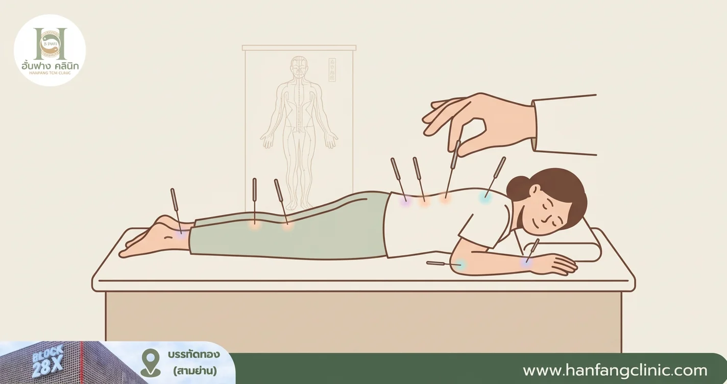 ฝังเข็มเพิ่มส่วนสูง