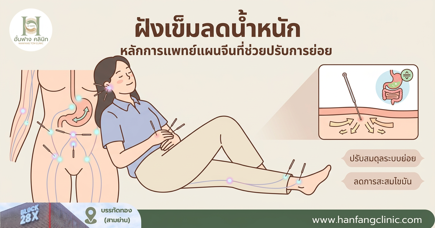 ฝังเข็มลดน้ำหนัก หลักการแพทย์แผนจีนที่ช่วยปรับการย่อย