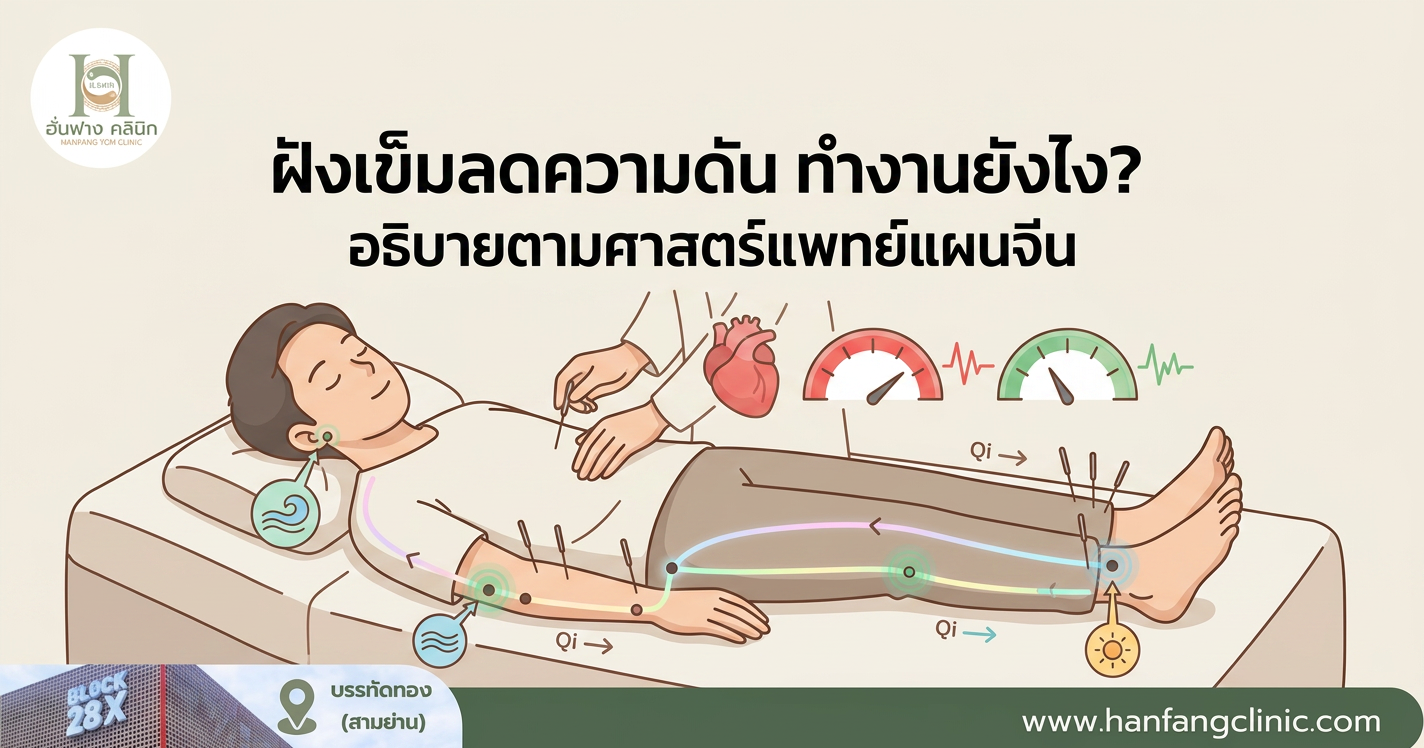 ฝังเข็มลดความดัน ทำงานยังไง? อธิบายตามศาสตร์แพทย์แผนจีน