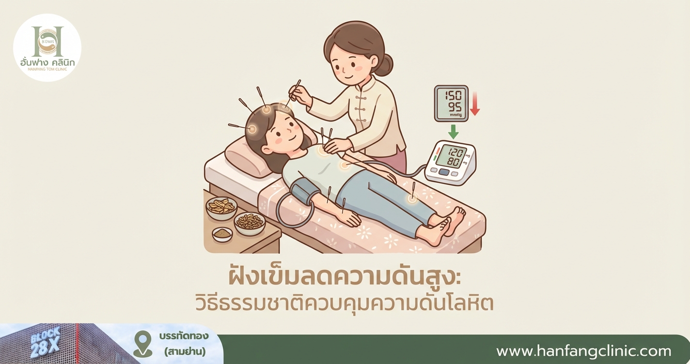 ฝังเข็มลดความดันสูง: วิธีธรรมชาติควบคุมความดันโลหิต
