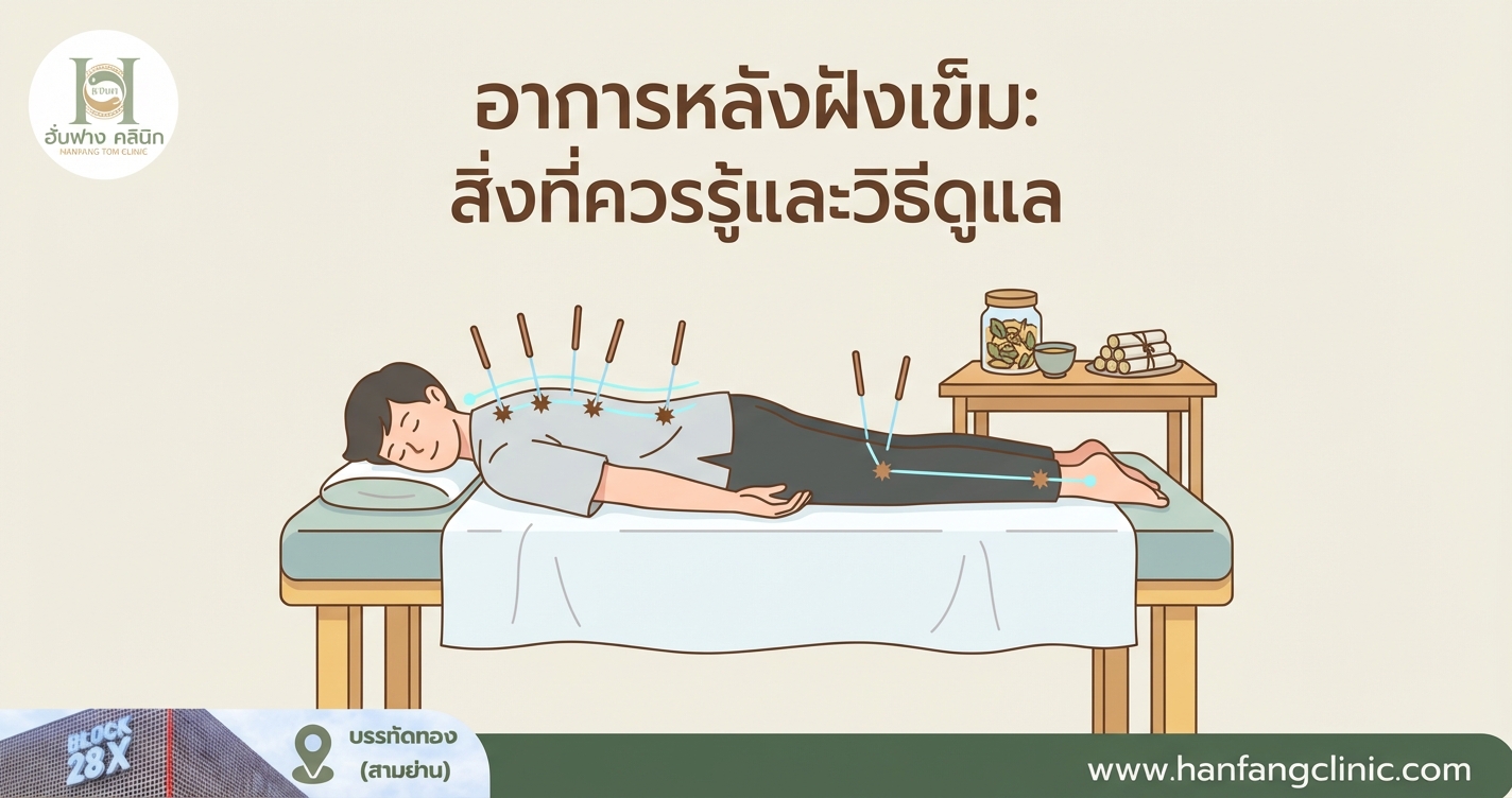 อาการหลังฝังเข็ม: สิ่งที่ควรรู้และวิธีดูแล