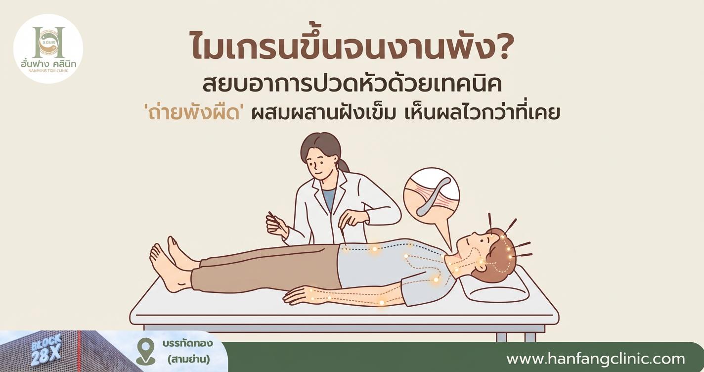 ไมเกรนขึ้นจนงานพัง? สยบอาการปวดหัวด้วยเทคนิค 'ถ่ายพังผืด' ผสมผสานฝังเข็ม เห็นผลไวกว่าที่เคย