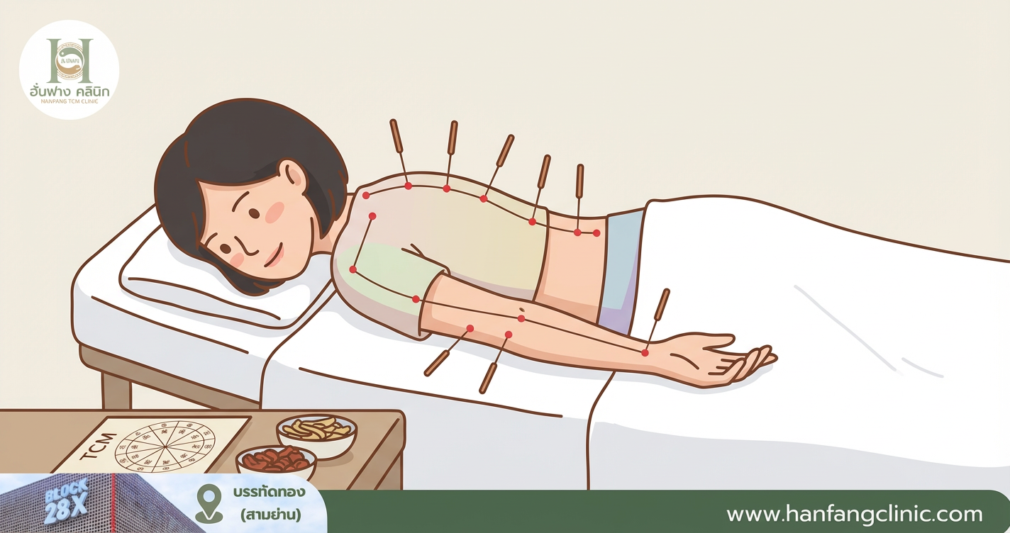 อาการหลังฝังเข็ม