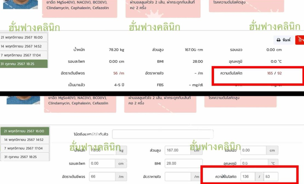 รีวิวจากคนไข้เคส 1